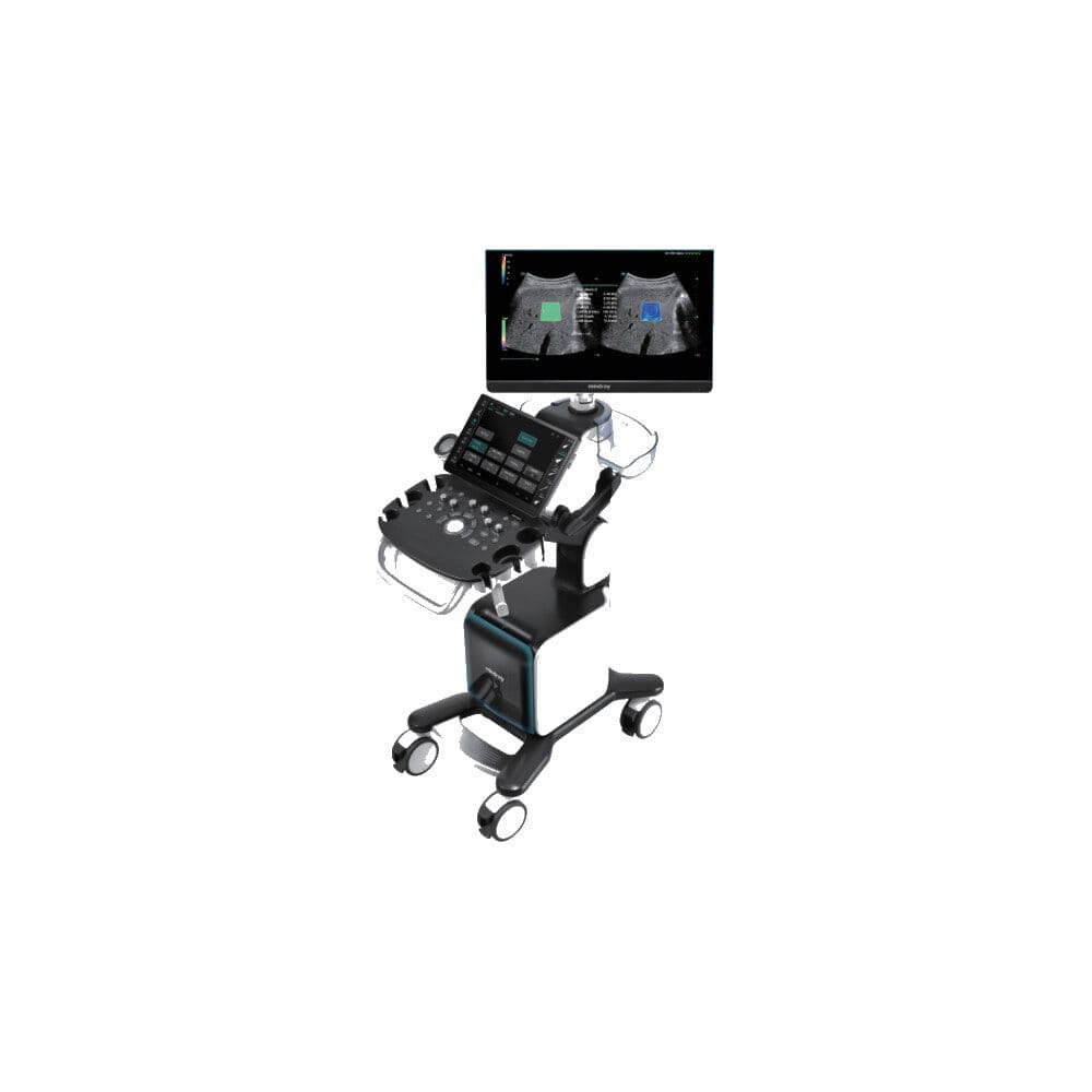 Mindray Consona N9 ultrasound system with a large monitor and touch control panel